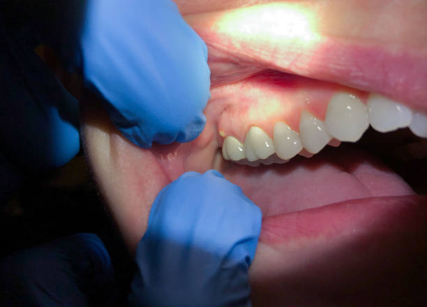 Best Walk-In Emergency Dentist in Mount Pleasant, MI