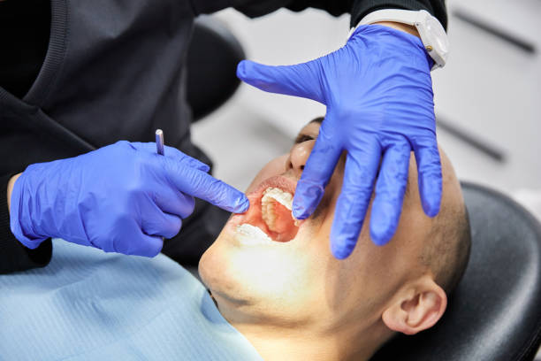 Best Emergency Tooth Extraction in Mount Pleasant, MI